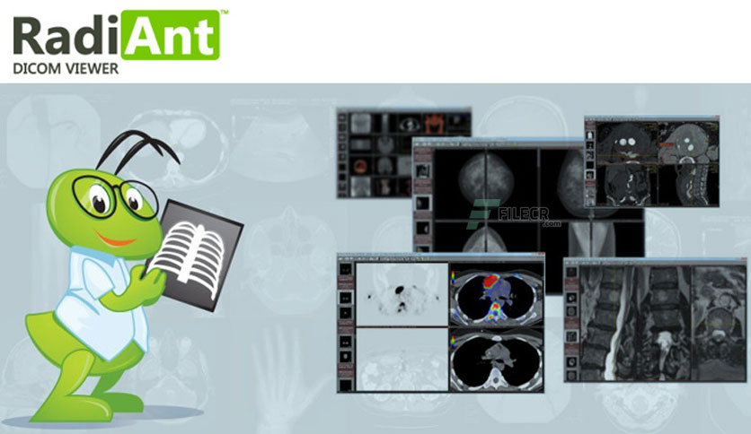 radiant-dicom-viewer-free-download-01