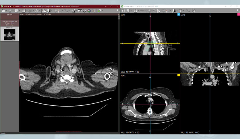 radiant-dicom-viewer-free-download-02