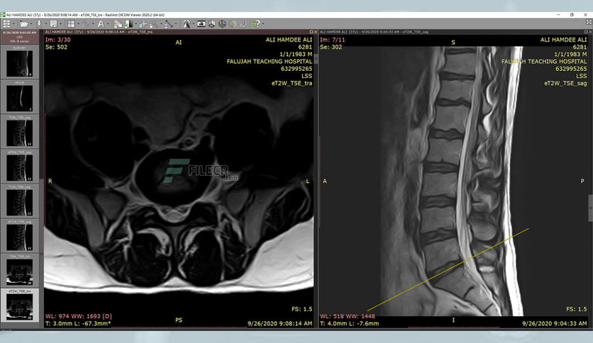 radiant-dicom-viewer-free-download-03