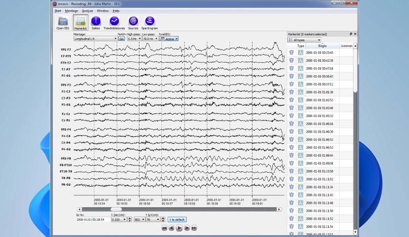66ebd3bb37331-ait-encevis-FeatureImage