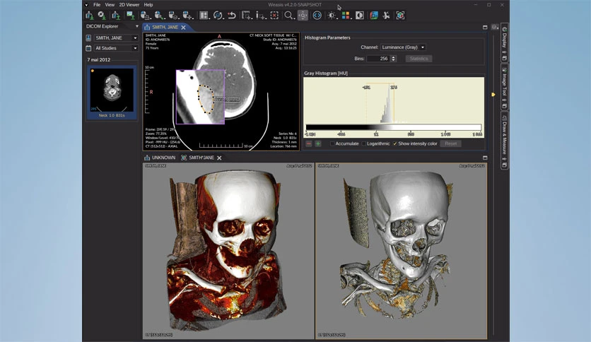 67d498fb74edc-weasis-dicom-viewer-FeatureImage