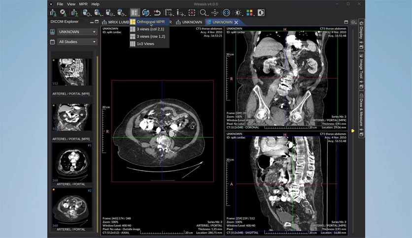 67d498f72c055-weasis-dicom-viewer-screenshot2