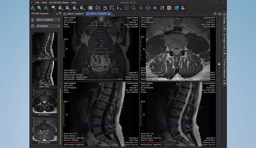 67d498f95af42-weasis-dicom-viewer-screenshot3