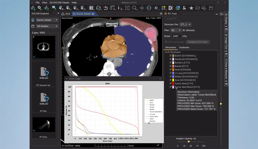 67d498f95e961-weasis-dicom-viewer-screenshot4