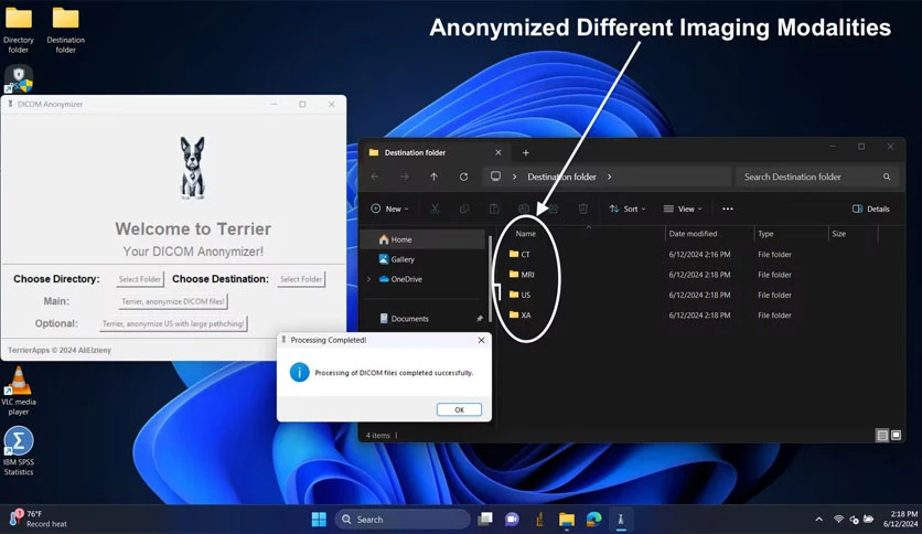 68ef78980cb19-terrier-anonymizer-FeatureImage