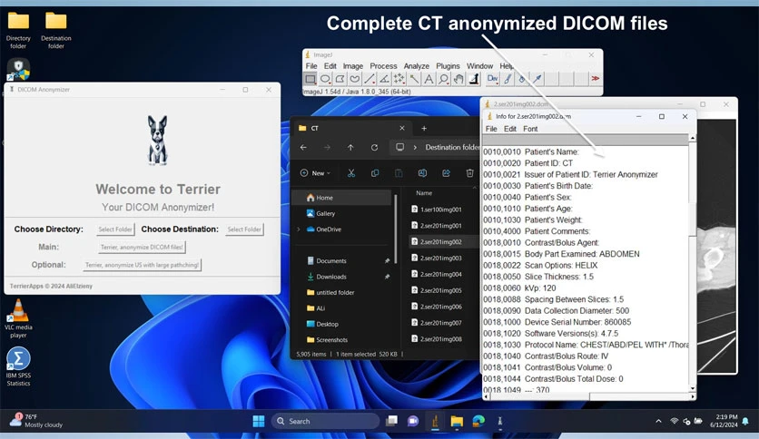 68ef803e5abd7-terrier-anonymizer-screenshot13