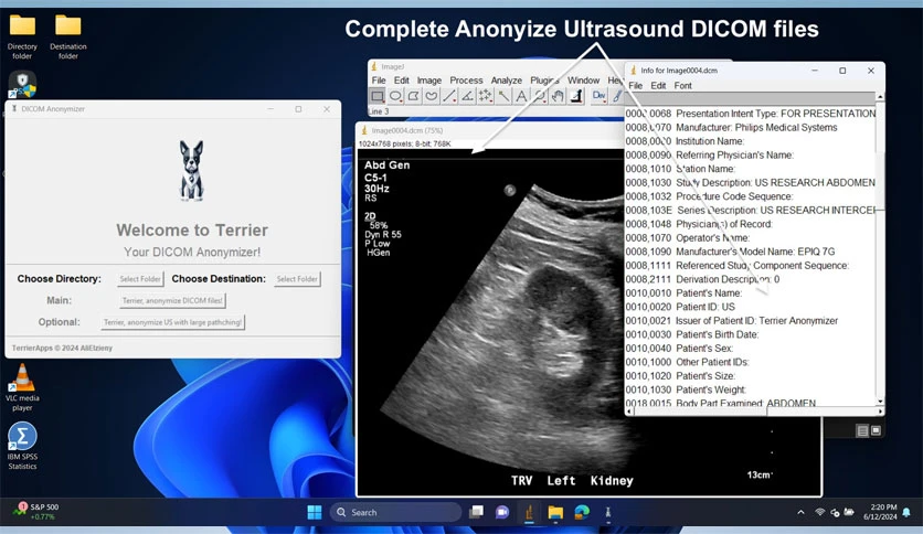 68ef803fbc9b0-terrier-anonymizer-screenshot15